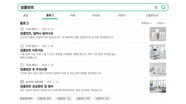 같은 임플란트 블로그 검색 결과에서 맨 위 세 건이 T치과 블로그의 글 — 임플란트, 얼마나 걸리나요 · 임플란트 아픈가요 · 임플란트 후 주의사항 — 으로 바뀐 검색 화면