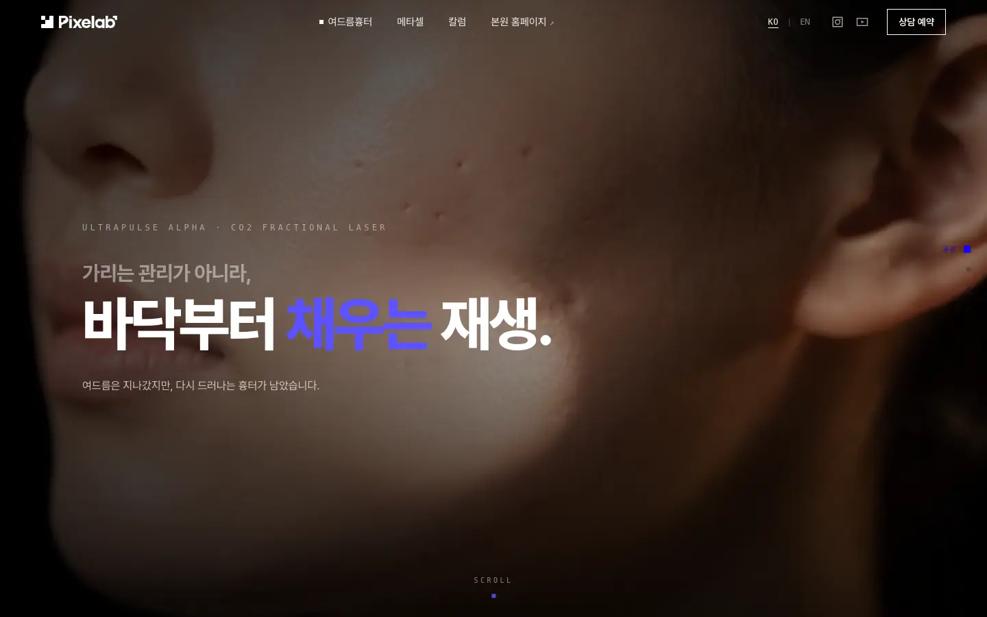 픽셀랩성형외과 여드름흉터 페이지를 위에서 아래로 스크롤하는 화면